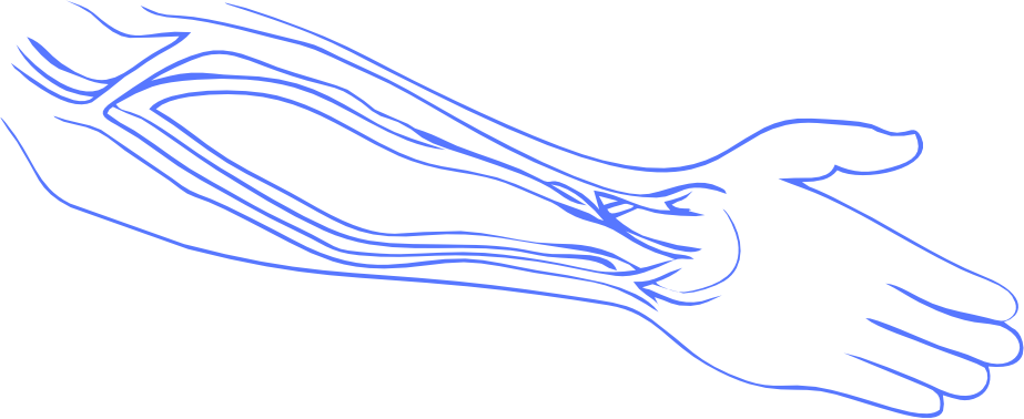 Vascular surgery and AV fistula treatment